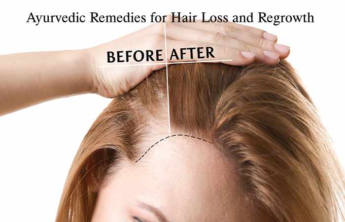 Ayurvedic Remedies for Hair Loss and Regrowth